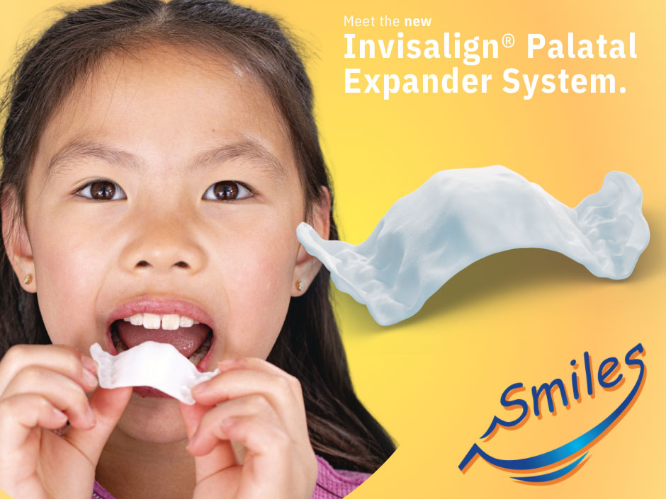 Invisalign Palatal Expander