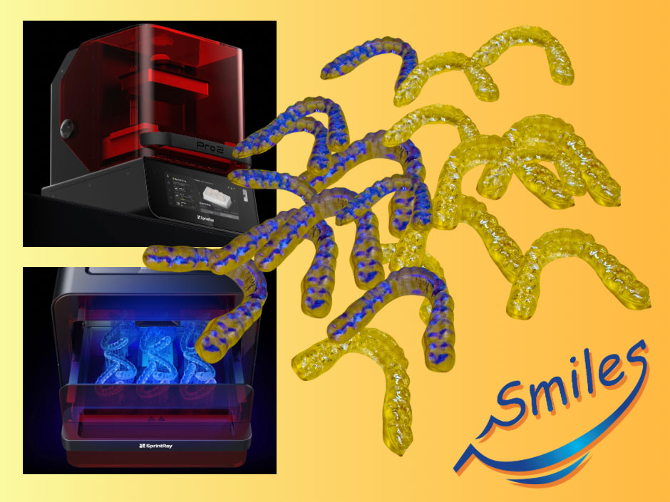 Orthodontic Retainers