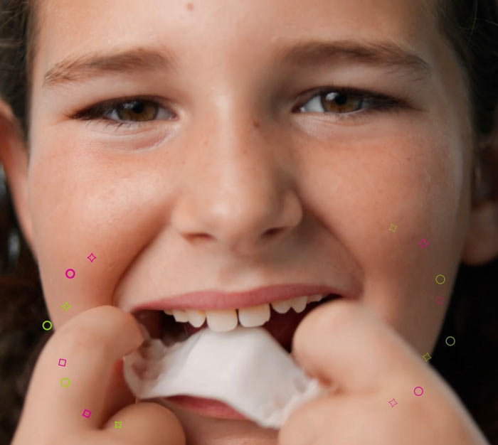 Invisalign Expander for Teen Orthodontic Care