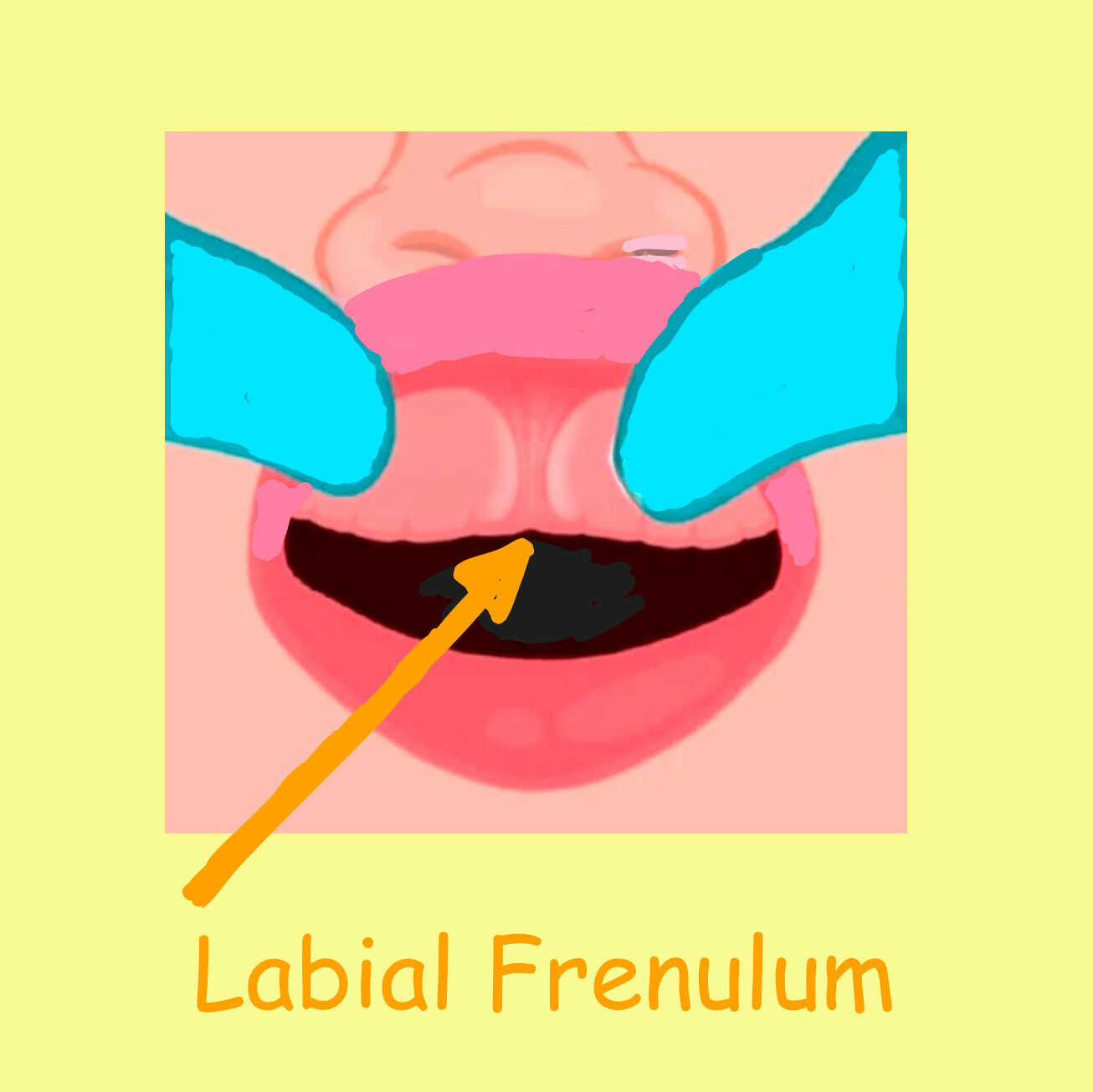 Infant Toddler Pediatric Dentistry Lip Tie