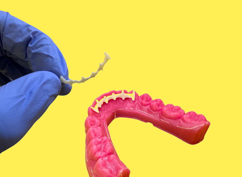3D Printed Orthodontic Fixed Retainers