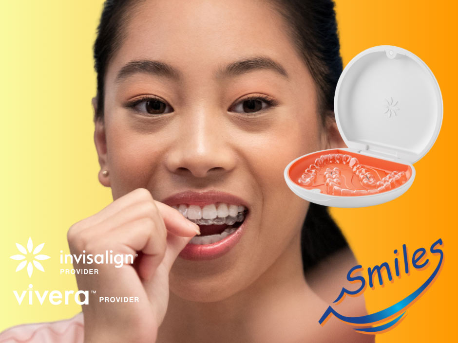 Clear Aligners for Teens