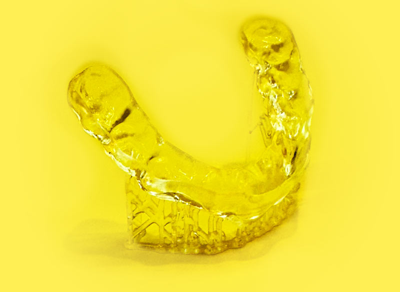 Teenage Esthetic Dentistry 3D Printing